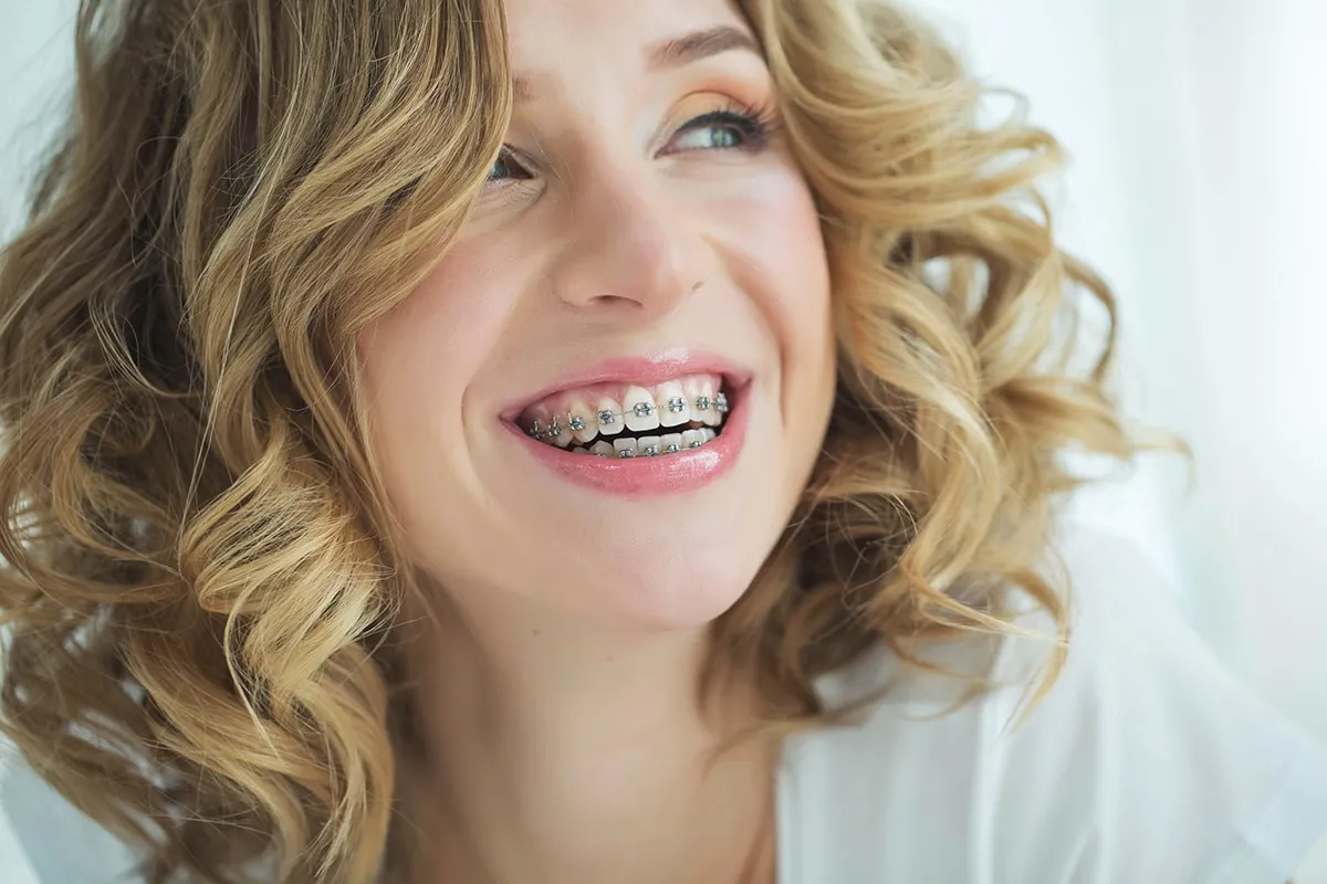 Braces in Pearland, TX