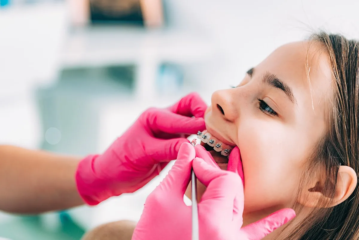 Braces for Kids in Pearland TX